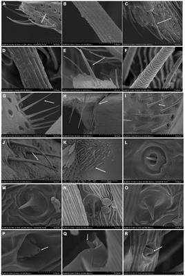 Find My Way to You: A Comparative Study of Antennal Sensilla and Olfactory Genes in Slug Moth With Different Diet Ranges (Lepidoptera: Limacodidae)